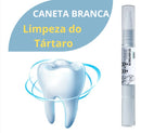 Limpador Dental HighClean| Limpeza doTártaro Rápida e Indolor!